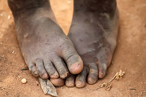 At Pad Their Feet Initiative, we give people an opportunity to own their own shoes, especially children